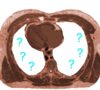 lung