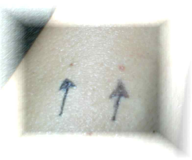before treatment